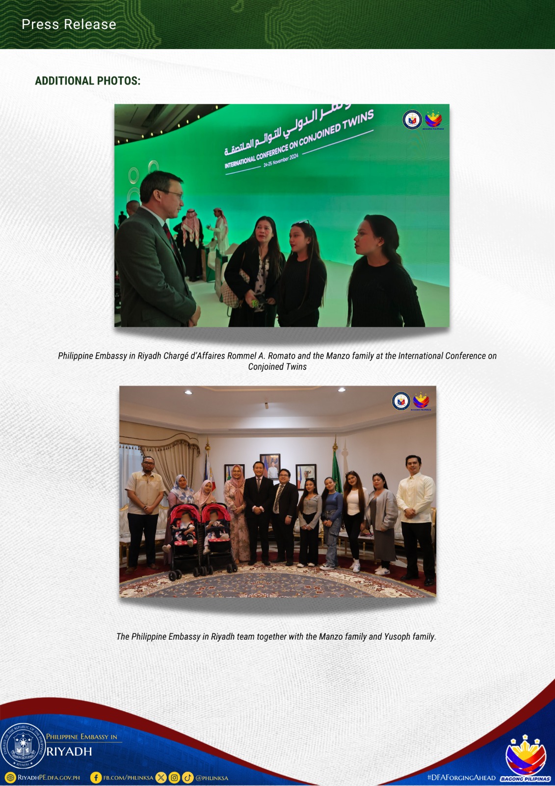 FILIPINO TWINS PERSONIFY HOPE AND THE TRIUMPH OF THE HUMAN SPIRIT AT THE INTERNATIONAL CONFERENCE ON CONJOINED TWINS IN RIYADH KSA 02