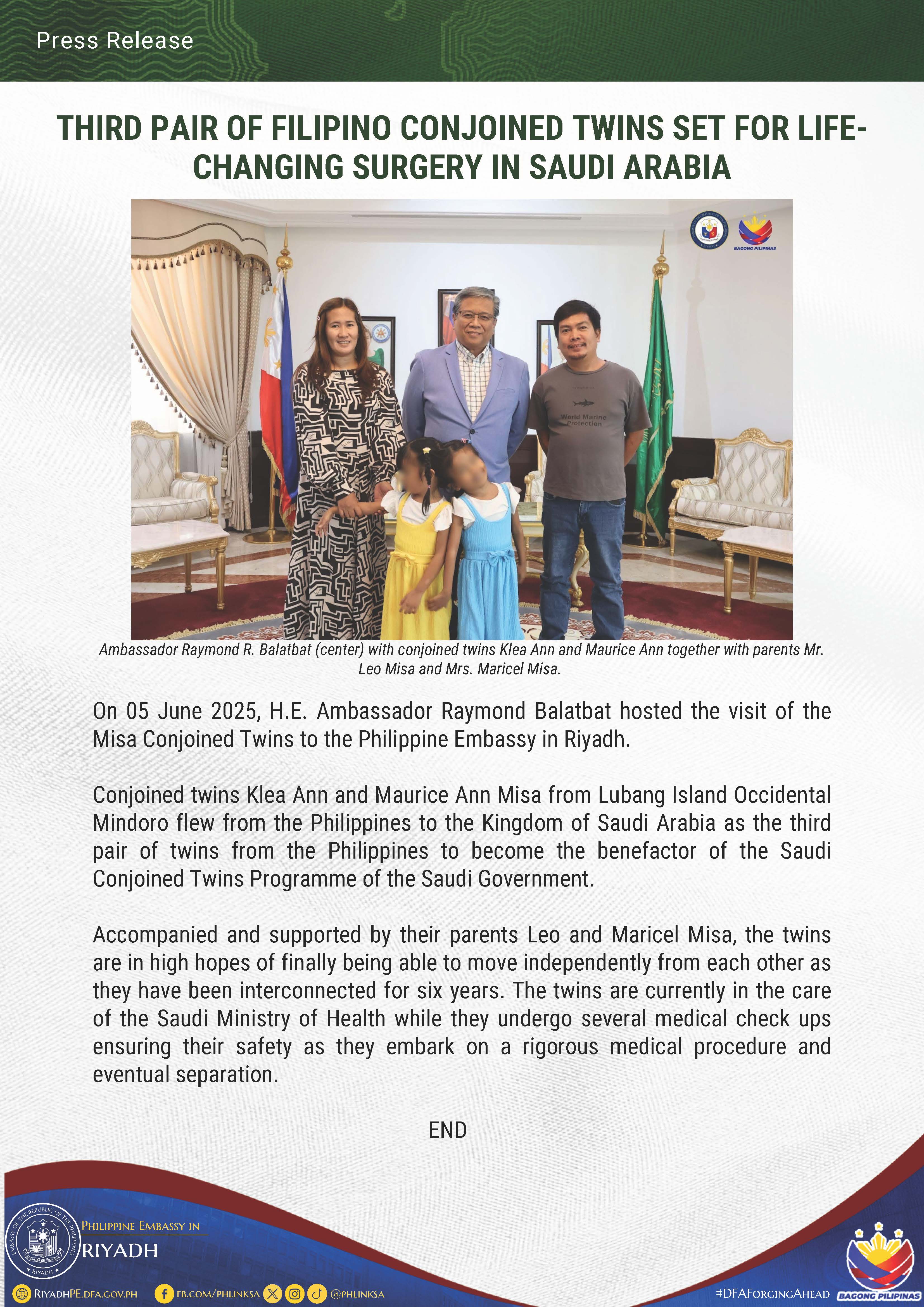PR 026 2025 Third Pair of Filipino Conjoined Twins Set for Life Changing Surgery in Saudi Arabia Page 1